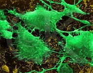 cancer cell